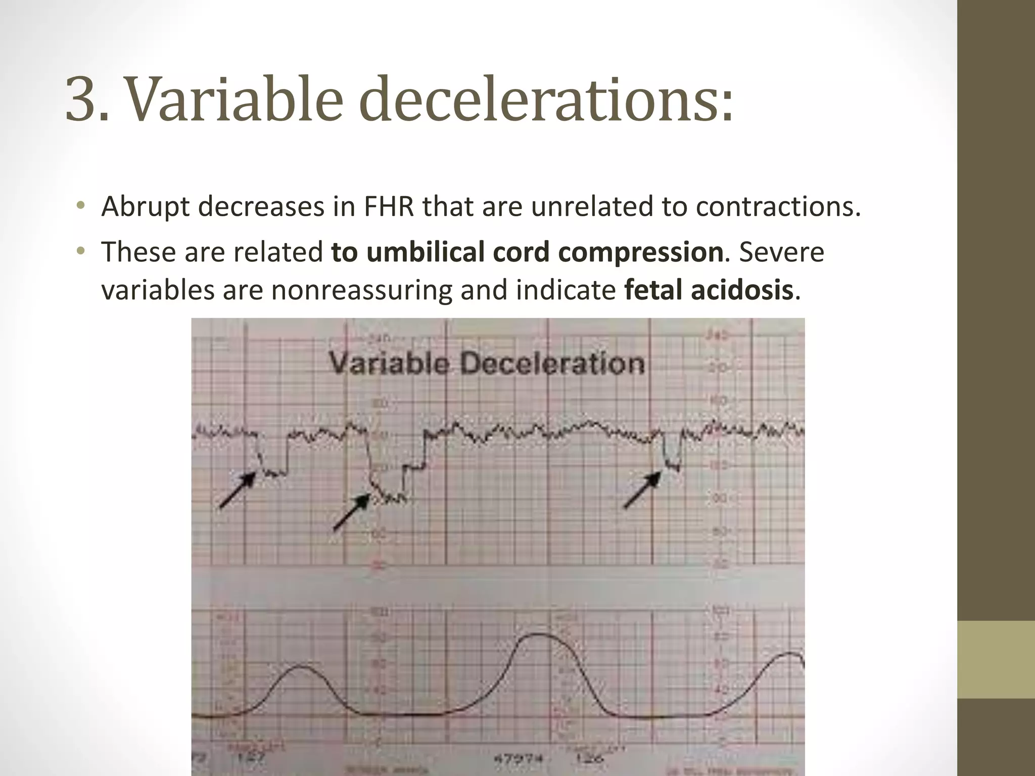 3. Variable decelerations:
• Abrupt decreases in FHR that are unrelated to contractions.
• These are related to umbilical cord compression. Severe
variables are nonreassuring and indicate fetal acidosis.
 
