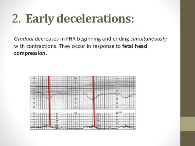 Evaluating Of Fetal Heart Tracing