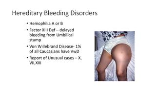 Evaluation-Of-Bleeding-Disorders hematology.pdf