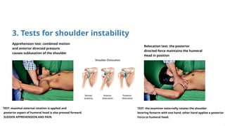 Internal Rotation Relocation Test Evaluation of Shoulder Pain: Clinical Examination, Special Tests ...