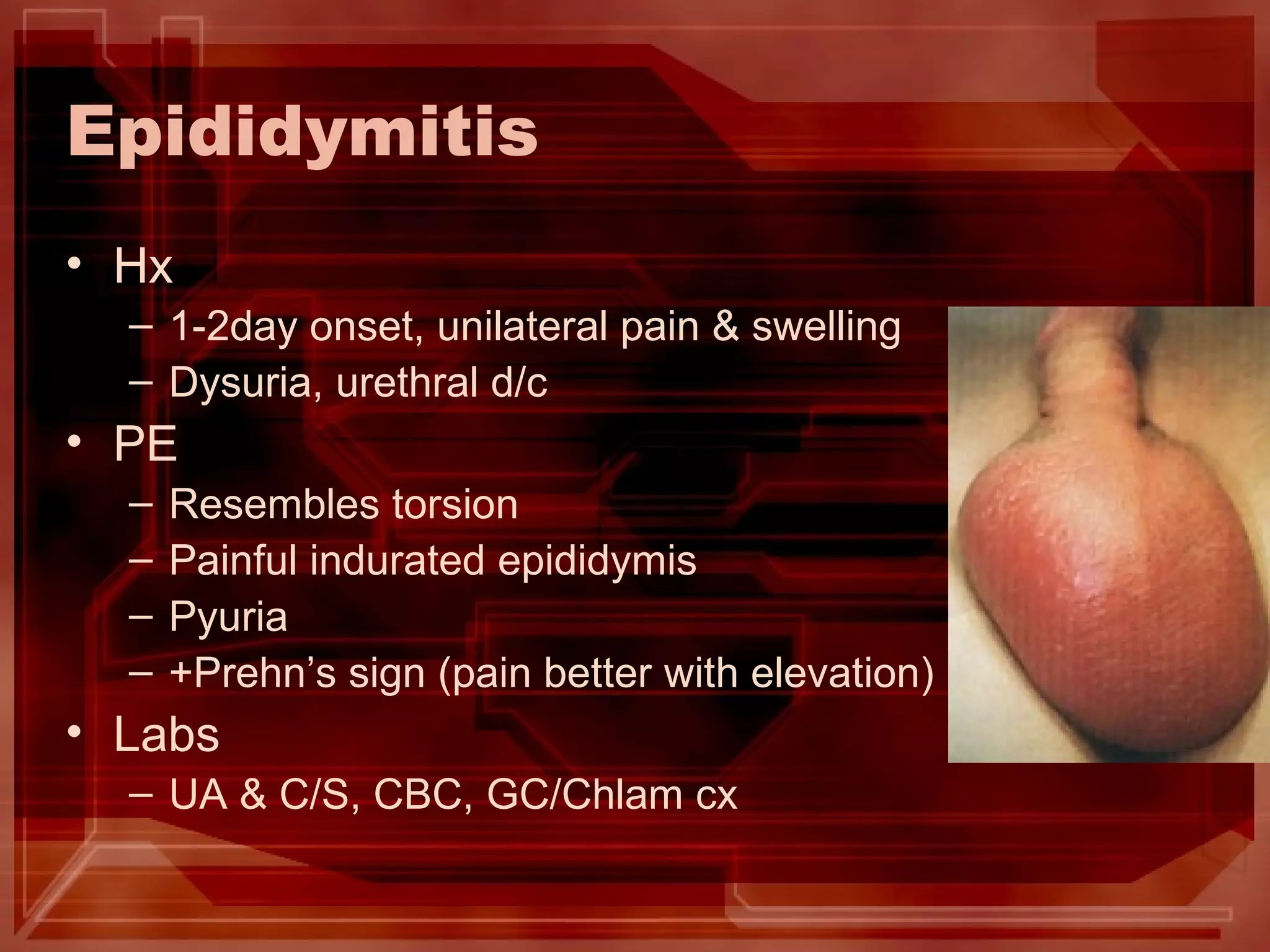 Evaluation of Testicular Pain | PPT