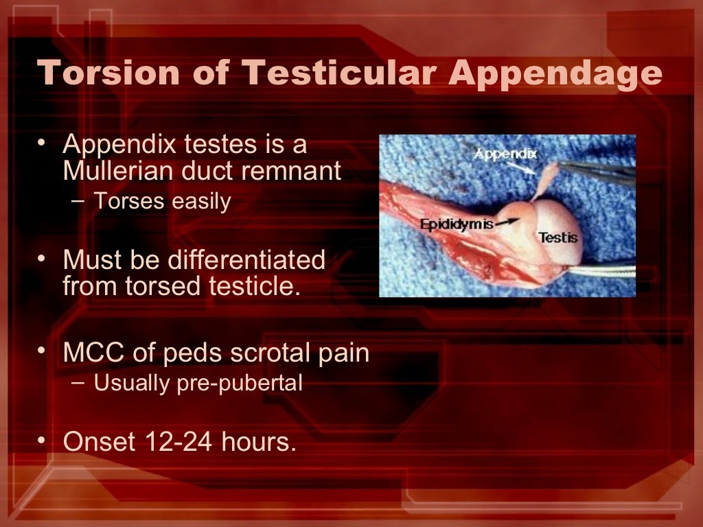 Evaluation of Testicular Pain