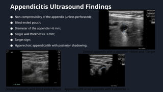 evaluationabdominalpain-240127042247-f6f2a639.pptx