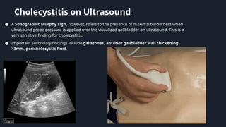 evaluationabdominalpain-240127042247-f6f2a639.pptx