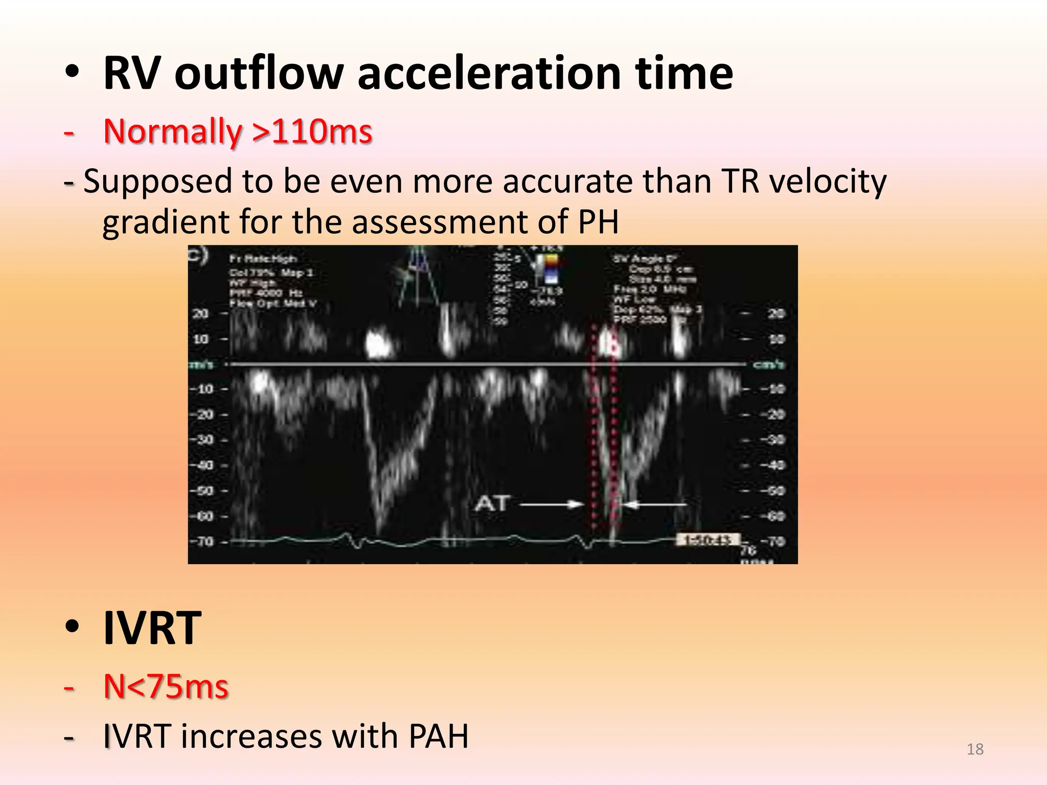 Evaluation and Management of pulmonary artery hypertension - dr sandeep ...