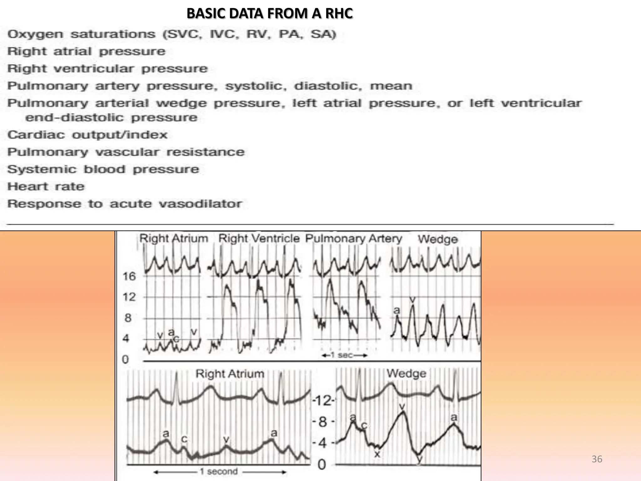 Evaluation and Management of pulmonary artery hypertension - dr sandeep ...