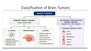 Classification of Brain Tumors
 