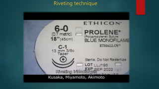 Lozenge Riveting Evaluation & management of iridodialysis final 08.01.20