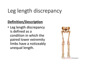 Leg length discrepancy
Definition/Description
• Leg length discrepancy
is defined as a
condition in which the
paired lower extremity
limbs have a noticeably
unequal length.
 