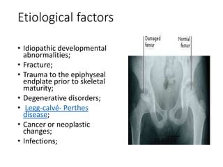 Etiological factors
• Idiopathic developmental
abnormalities;
• Fracture;
• Trauma to the epiphyseal
endplate prior to skeletal
maturity;
• Degenerative disorders;
• Legg-calvé- Perthes
disease;
• Cancer or neoplastic
changes;
• Infections;
 