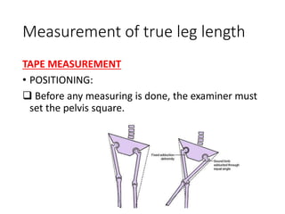 Measurement of true leg length
TAPE MEASUREMENT
• POSITIONING:
 Before any measuring is done, the examiner must
set the pelvis square.
 