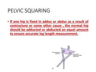 PELVIC SQUARING
• If one hip is fixed in adduc or abduc as a result of
contracture or some other cause , the normal hip
should be adducted or abducted an equal amount
to ensure accurate leg length measurement.
 