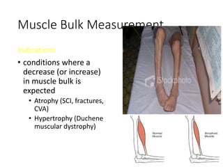 Muscle Bulk Measurement
Indications
• conditions where a
decrease (or increase)
in muscle bulk is
expected
• Atrophy (SCI, fractures,
CVA)
• Hypertrophy (Duchene
muscular dystrophy)
 