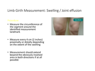 Limb Girth Measurement: Swelling / Joint effusion
Procedure
• Measure the circumference of
the segment around the
identified measurement
landmark
• Measure every 4 cm (2 inches)
proximally or distally depending
on the extent of the swelling
• Measurement should extend
beyond the obviously involved
area in both directions if at all
possible
 