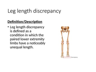 evaluation methods IN PHYSIOTHERAPY.pptx