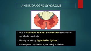 Evaluation of acute trauma in spine | PPTX