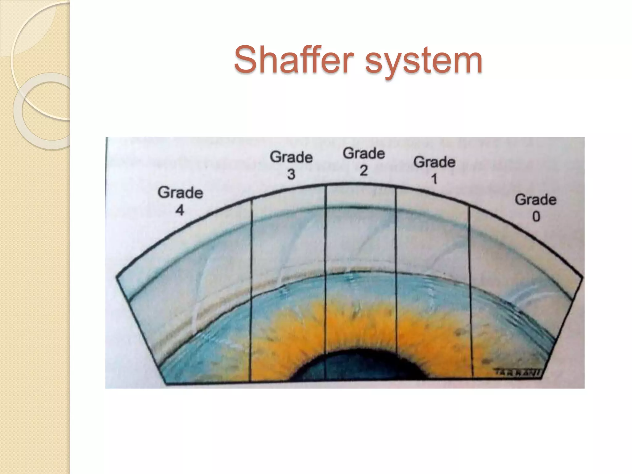 Shaffer system
 