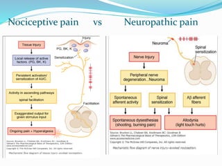 Nociceptive pain vs Neuropathic pain
 