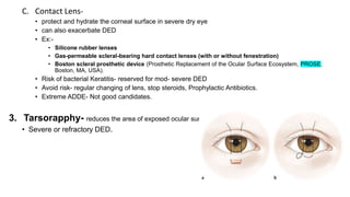 Evaluation of a patient of Dry Eye .pptx