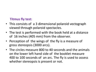 Timus Test EVALUATION OF A SQUINT PATIENT (4).pptx