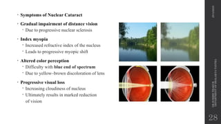 EVALUATION OF CATARACT BY DR. SURBHI THAKUR .pptx