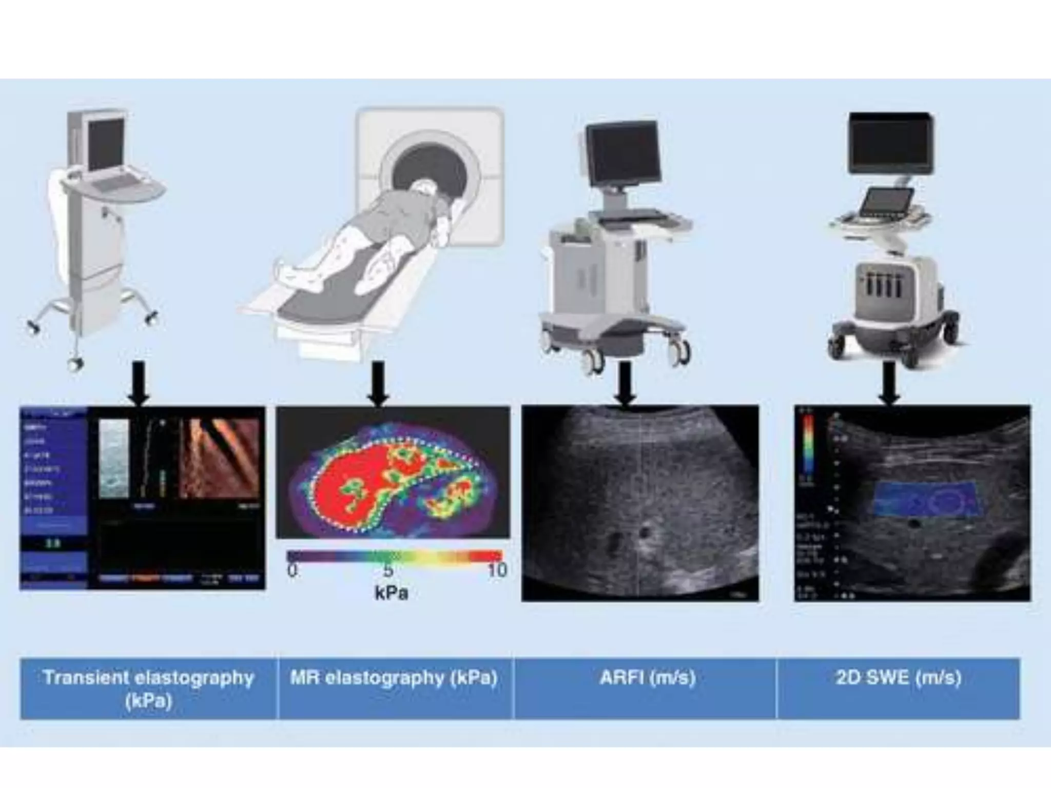 Evaluation of cirrhosis