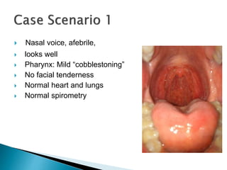  Nasal voice, afebrile,
 looks well
 Pharynx: Mild “cobblestoning”
 No facial tenderness
 Normal heart and lungs
 Normal spirometry
 