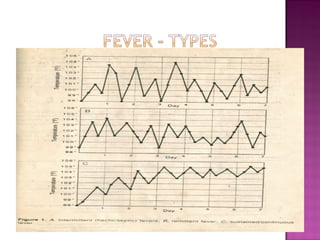 Fever Profile Chart.pdf Evaluation of a patient with fever | PPT