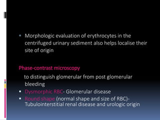 Evaluation of hematuria | PPTX
