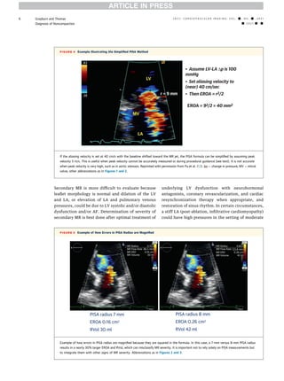 Evaluation of mitral regurgitation | PDF