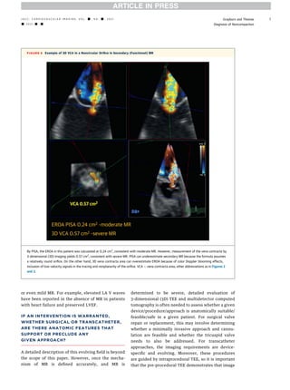 Evaluation of mitral regurgitation | PDF
