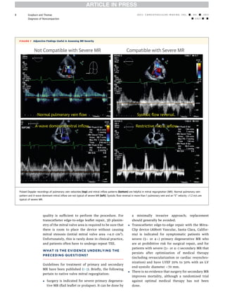 Evaluation of mitral regurgitation | PDF