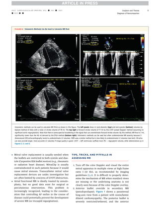 Evaluation of mitral regurgitation | PDF