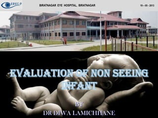 M
Evaluation of non seeing
infant
BY
DR DIWA LAMICHHANE
BIRATNAGAR EYE HOSPITAL, BIRATNAGAR 19 – 05 - 2013
 