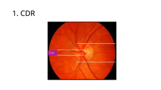 1. CDR
 