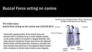Schematic representation of the buccal force and
moment with a tendency to tip a crown labially exerted
on the canine when it is moved in a lingual direction. Clin-
ically relevant reactionary forces occurred on the adjacent
lateral incisor and ﬁrst premolar, whereas a clinically rele-
vant moment occurred only on the adjacent lateral incisor
with a tendency to tip the lateral incisor crown lingually.
Buccal Force acting on canine
The initial mean
buccal force acting on the canine was 2.25 60.38 N
 