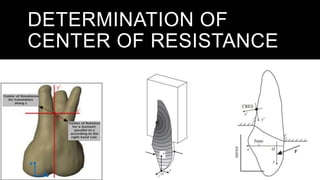 DETERMINATION OF
CENTER OF RESISTANCE
SAMPLE FOOTER TEXT 20XX 4
 