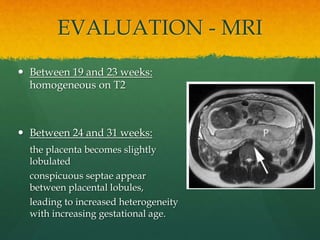 EVALUATION - MRI
 Between 19 and 23 weeks:
homogeneous on T2
 Between 24 and 31 weeks:
the placenta becomes slightly
lobulated
conspicuous septae appear
between placental lobules,
leading to increased heterogeneity
with increasing gestational age.
 