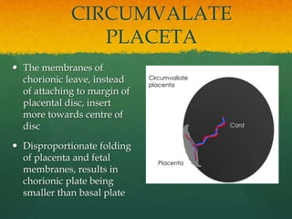 The membranes of
chorionic leave, instead
of attaching to margin of
placental disc, insert
more towards centre of
disc
 Disproportionate folding
of placenta and fetal
membranes, results in
chorionic plate being
smaller than basal plate
CIRCUMVALATE
PLACETA
 