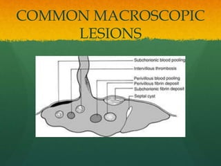 COMMON MACROSCOPIC
LESIONS
 