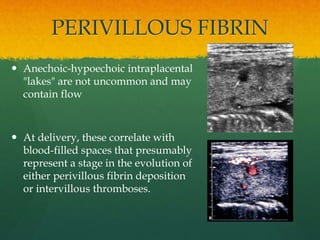PERIVILLOUS FIBRIN
 Anechoic-hypoechoic intraplacental
"lakes" are not uncommon and may
contain flow
 At delivery, these correlate with
blood-filled spaces that presumably
represent a stage in the evolution of
either perivillous fibrin deposition
or intervillous thromboses.
 