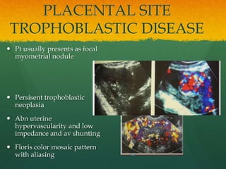 PLACENTAL SITE
TROPHOBLASTIC DISEASE
 Pt usually presents as focal
myometrial nodule
 Persisent trophoblastic
neoplasia
 Abn uterine
hypervascularity and low
impedance and av shunting
 Floris color mosaic pattern
with aliasing
 