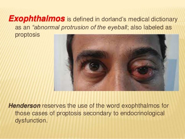 exophthalmos