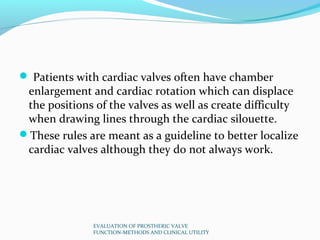  Patients with cardiac valves often have chamber
 enlargement and cardiac rotation which can displace
 the positions of t...