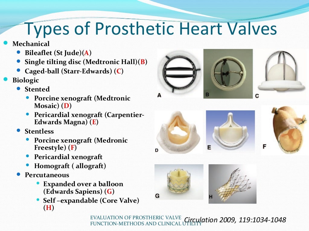 Evaluation of prosthetic valve function and clinical utility.