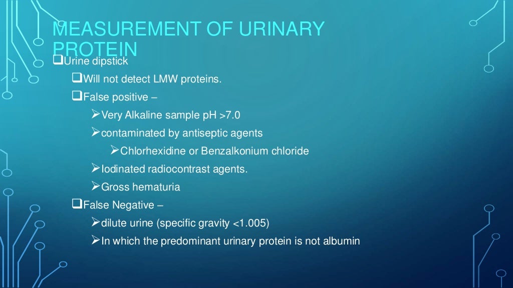 Evaluation of proteinuria in children by Dr.B.Sivakanth