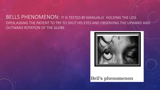 Evaluation of ptosis | PPTX