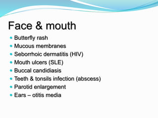 Face & mouth
 Butterfly rash
 Mucous membranes
 Seborrhoic dermatitis (HIV)
 Mouth ulcers (SLE)
 Buccal candidiasis
 Teeth & tonsils infection (abscess)
 Parotid enlargement
 Ears – otitis media
 