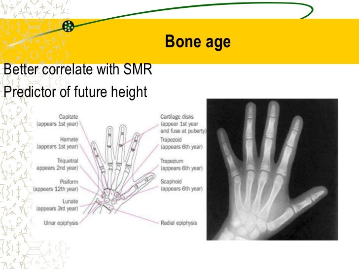 evaluation of short stature in children stature for age growth chart
