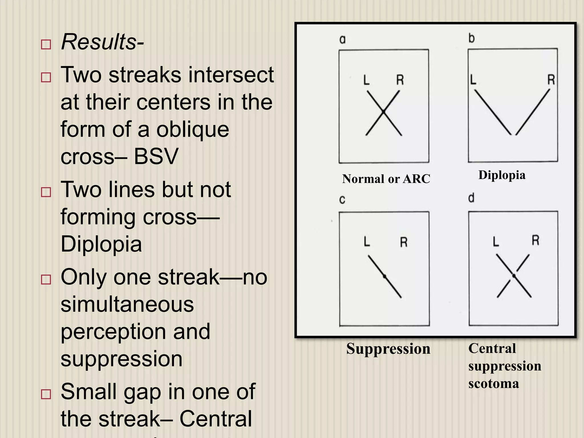 Evaluation of squint